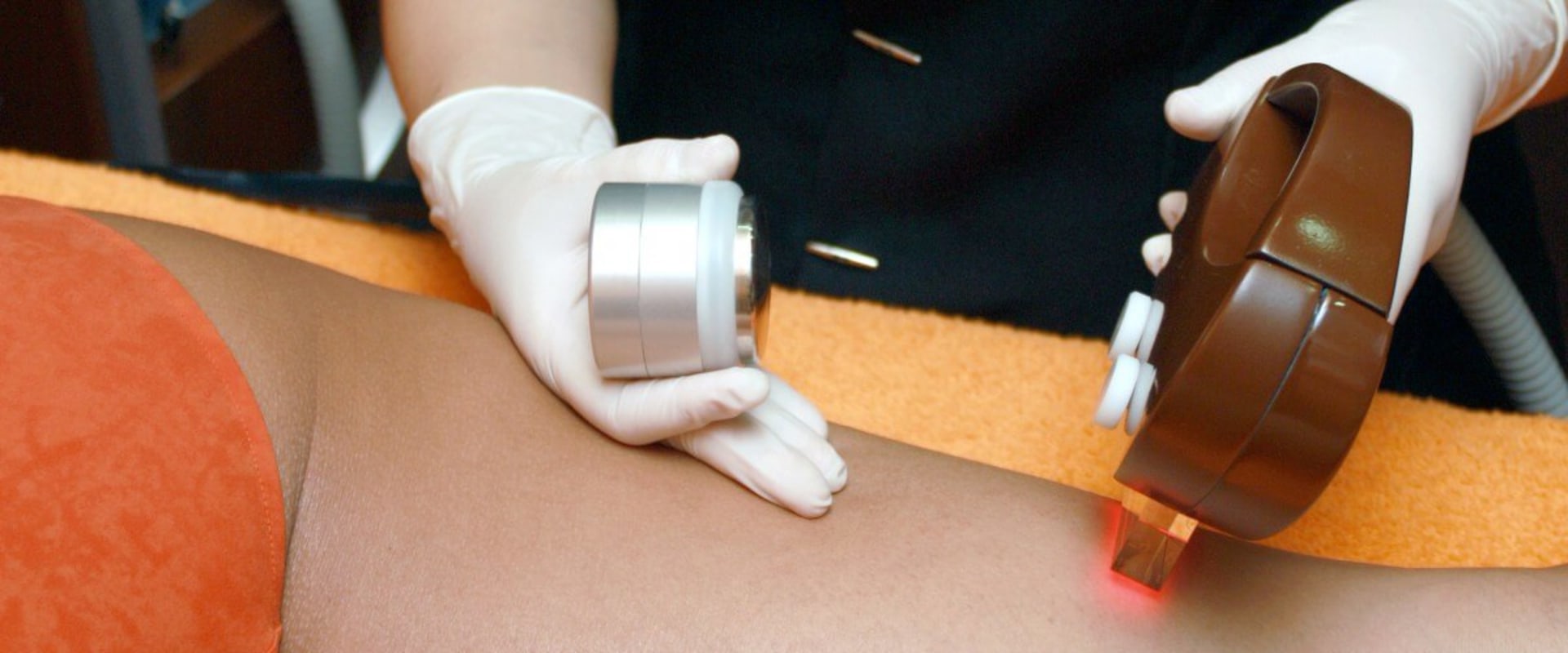 Can laser lipo cause infertility?