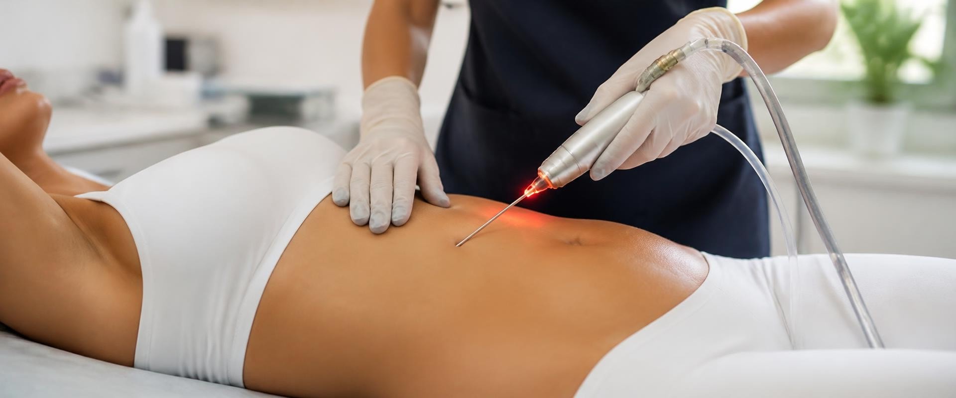 How Laser Liposuction Can Be Used to Target Stubborn Fat Areas