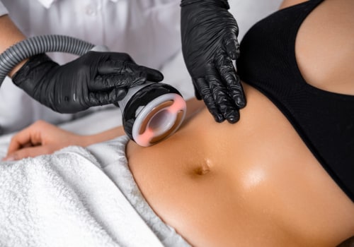 Achieve Your Body Goals with Laser Liposuction & Affordable Gym Prices